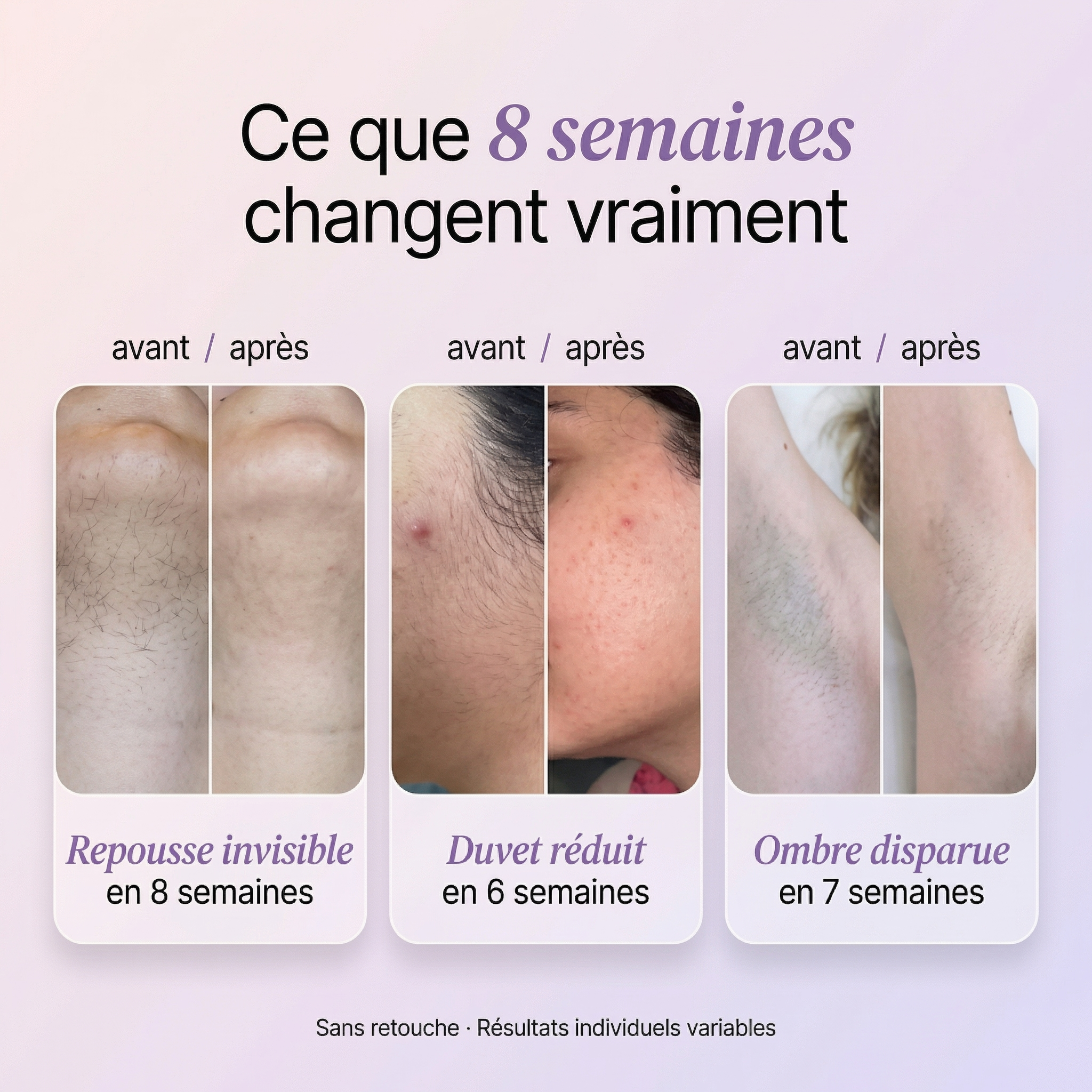 Sérum Anti-Repousse 100% Naturel — CYPERUS Paris™