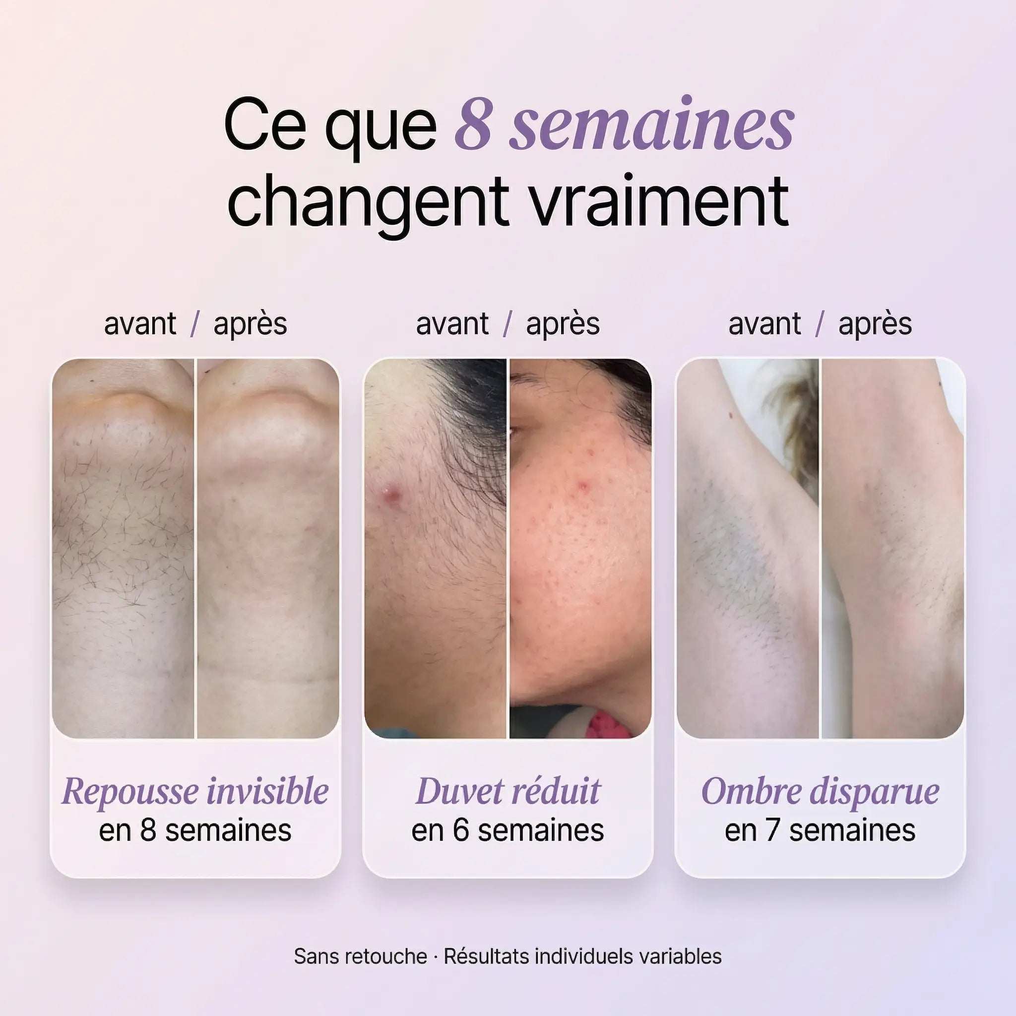 Sérum Anti-Repousse 100% Naturel - Fini de se cacher à cause de ses poils.
